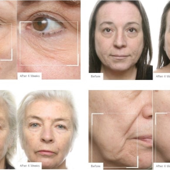 048- Neo-Filler Lift Corrective Elixir - Silver - Picture 7 of 7